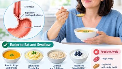 Achalasia diet showing soft foods that are easier to eat and swallow