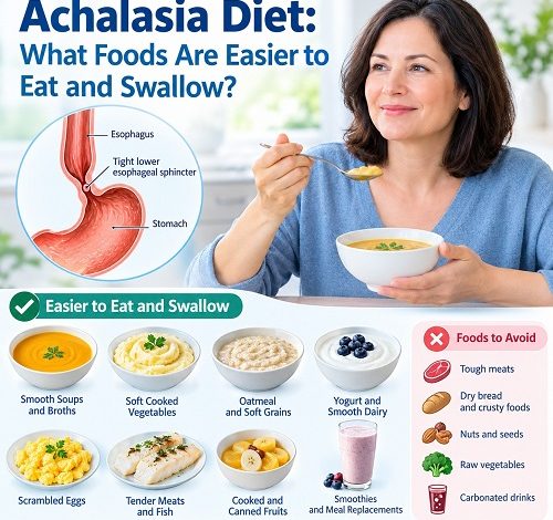 Achalasia diet showing soft foods that are easier to eat and swallow