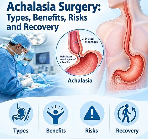 Achalasia surgery showing Heller myotomy and POEM treatment approaches