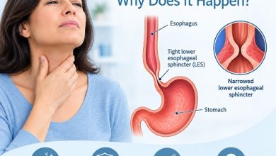 Achalasia and difficulty swallowing showing impaired food movement through the oesophagus