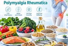 Anti-inflammatory foods for polymyalgia rheumatica including vegetables, berries, salmon, nuts and olive oil