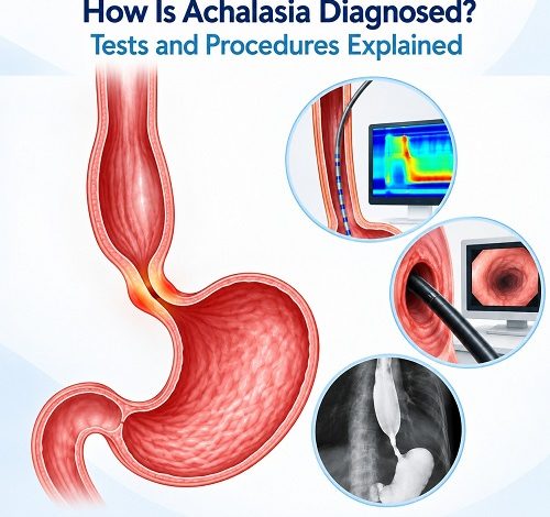 How Is Achalasia Diagnosed