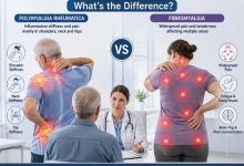 Polymyalgia Rheumatica vs Fibromyalgia comparison showing muscle pain and stiffness