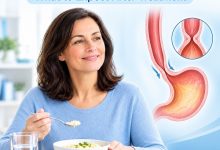 Patient recovering after achalasia treatment while following a soft-food diet
