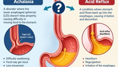 SEO title Achalasia and Acid Reflux: Are They Connected? Meta description Learn how achalasia and acid reflux differ, why heartburn can occur, and how reflux after achalasia treatment is diagnosed and managed. Slug / URL achalasia-and-acid-reflux Focus keyword achalasia and acid reflux Secondary keywords GERD, reflux after achalasia treatment, heartburn Image alt text Medical illustration showing achalasia of the oesophagus, the lower oesophageal sphincter and the stomach, highlighting how swallowing difficulties and acid reflux can differ. Post tags Achalasia, Acid Reflux, GERD, Heartburn, Oesophageal Disorders, Achalasia Treatment, Digestive Health, Reflux After Achalasia Treatment