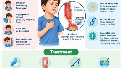 Achalasia in Children