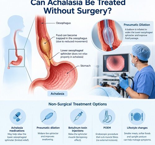 Achalasia treatment without surgery showing the oesophagus, lower oesophageal sphincter and non-surgical treatment options