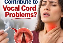 Can Smoking Contribute to Vocal Cord Problems