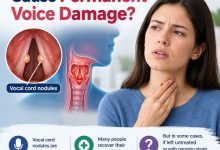 Can Vocal Cord Nodules Cause Permanent Voice Damage