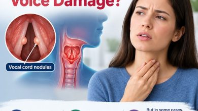 Can Vocal Cord Nodules Cause Permanent Voice Damage