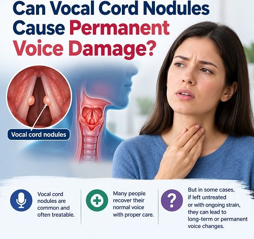 Can Vocal Cord Nodules Cause Permanent Voice Damage