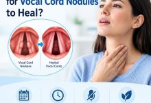 Medical illustration of the vocal folds showing vocal cord nodules and the healing process.