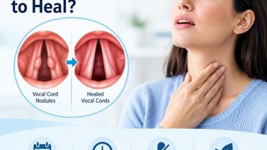 Medical illustration of the vocal folds showing vocal cord nodules and the healing process.