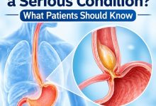 Is Achalasia a Serious Condition