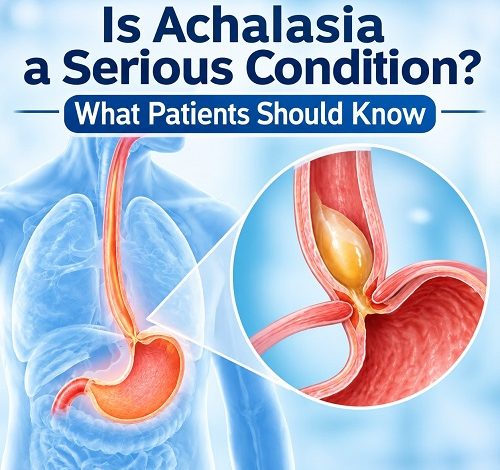 Is Achalasia a Serious Condition