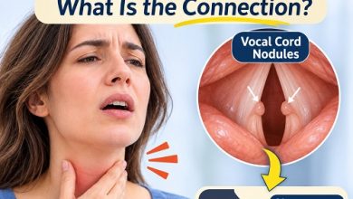 Medical illustration showing vocal cord nodules on the vocal folds and how they affect normal voice production.