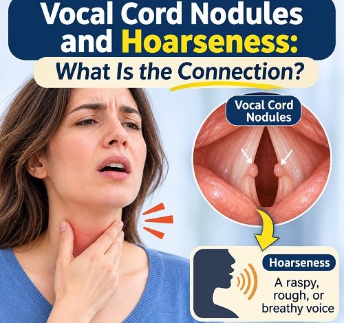 Medical illustration showing vocal cord nodules on the vocal folds and how they affect normal voice production.