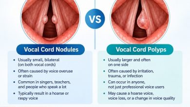 Vocal cord nodules vs polyps showing differences between two types of vocal fold lesions