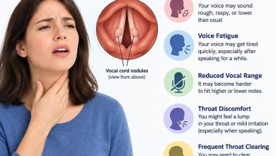 Medical illustration of vocal cord nodules on the vocal folds inside the larynx, showing how small benign growths can affect voice quality.